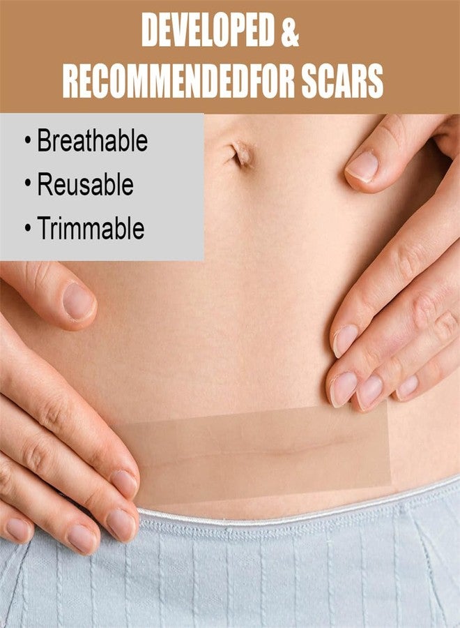 Yeasing Silicone Scar Sheets 1.57" x 19.68" Silicone Skin Patches C Section Recovery Extra Long Silicone Scar Tape Scar Removal Strips Tummy Tuck Tape for Acne Scars C-Section Keloid - Image 5